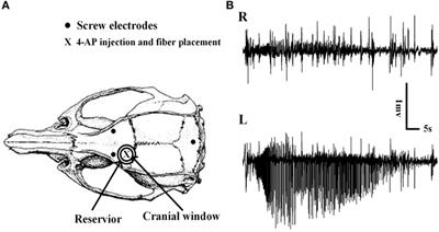 Photolysis of Caged-GABA Rapidly Terminates Seizures In Vivo: Concentration and Light Intensity Dependence